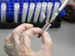 Ученый успокоил россиян относительно появления нового вируса СПИДа