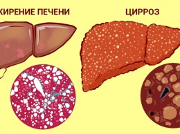 А что, если печень можно вылечить травами? 5 проверенных тысячами людей рецептов