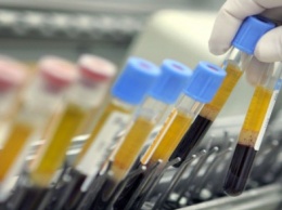 Ученые: ГРААЛЬ сможет обнаруживать рак по анализу крови