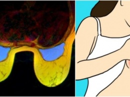 8 видов боли в груди, которые должны вас насторожить