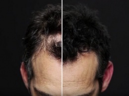 «Временные волосы»: спрей, который замаскирует лысину или плохую стрижку