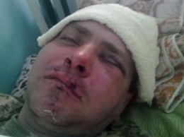 Чудом остался жив: в Измаиле жестоко избили бойца "Правого сектора" за участие в АТО