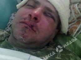В Одесской области боец АТО попал в драку (фото)