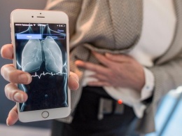 Ученые создали насадку для смартфона для диагностики опасных заболеваний
