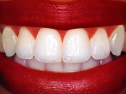 Ученые: Мята предотвращает разрушение зубов
