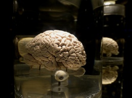 Найдена взаимосвязь между формой коры мозга и характером человека