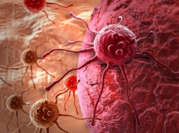Ученые выяснили, как раковые клетки начинают распространяться по организму