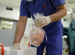 Эксперты: Химера может стать прорывом в трансплантологии