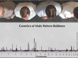 Генетики научились предсказывать, как сильно полысеет мужчина в 40 лет