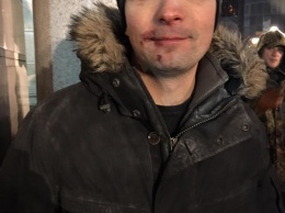 В ходе столкновений в центре Киева избили нардепа Соболева