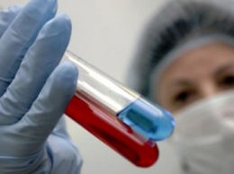 Добропольское отделение профилактики ВИЧ/СПИД получило антиретровирусные препараты