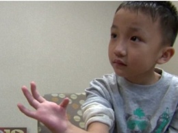 Хирурги отрастили ребенку большой палец на руке