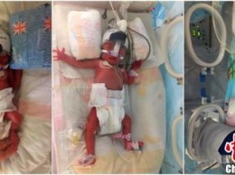 В Китае женщина родила близнецов через шесть дней после рождения сына