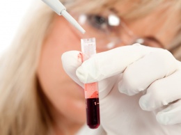 СМИ: ученые выявили наиболее восприимчивую группу крови к заболеваниям