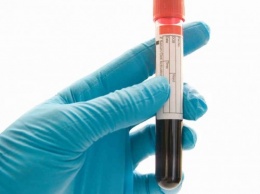 Американские ученые создали тест на рак по анализу крови