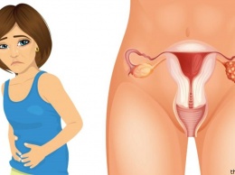 4 ранних симптома рака яичников, о которых должна знать каждая женщина