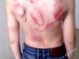 В Одесской области отец избил шестиклассника за плохую оценку (видео)