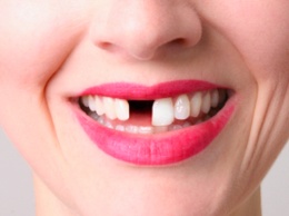 Ученые: Кокаин плохо влияет на зубы и десны