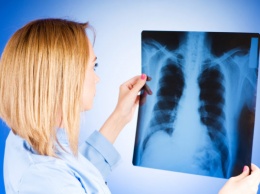 Запорожские медики рассказали, как бороться с туберкулезом