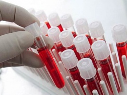 Ученые рассказали о "самой сексуальной" группе крови