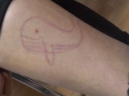"Синий кит" на Сумщине: около 30 учеников имеют на теле характерные порезы