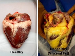 Эти 10 продуктов очистят ваши артерии и предотвратят сердечный приступ!