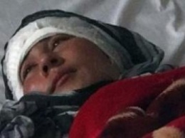 Шокирующий случай в Афганистане: муж-изверг отрезал уши своей жене