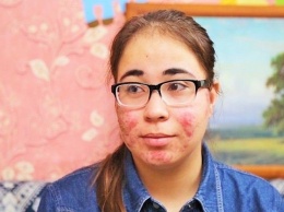Девушку из Тюмени будут лечить в рамках реалити-шоу