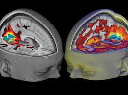 Психоделические препараты стимулируют разнообразие деятельности мозга