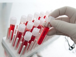 Группа крови может рассказать о личности человека - ученые