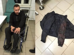 Харьковские титушки АХ «Мрия» жестоко избили ветерана АТО на Тернопольщине
