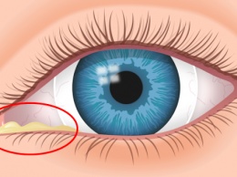 Так вот почему по утрам в уголках глаз появляется засохшая слизь!