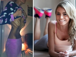 До и После: 15 фото людей, которые победили анорексию