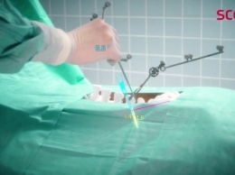 Microsoft HoloLens помогают хирургам оперировать позвоночник