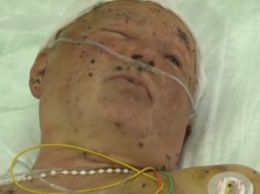 В больнице Днепра пришел в сознание раненый боец