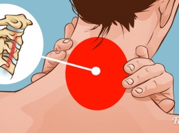Если у вас болит шея, запомните эти 5 советов
