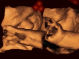 Ученые: зародыш реагирует на лица людей еще внутри утробы матери