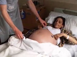 Эта женщина выпивала по 3 бутылки вина ежедневно. Ее живот стал таким огромным, что ее принимают за беременную!