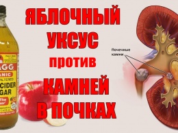 Вот 4 народных способа растворить камни в почках. Нужен только уксус!