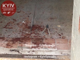 В киевском ЖЭКе неизвестные прострелили мужчине голову