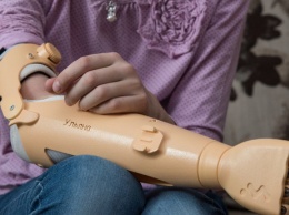 Компания «Моторика» ищет белорусских детей для бесплатного протезирования