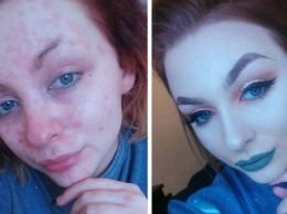 Бьюти-блогер с псориазом до и после макияжа