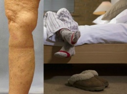Если вы чувствуете боль в ногах среди ночи или когда ложитесь в кровать? У вас может быть синдром беспокойных ног. Вот, как избавиться от этого!