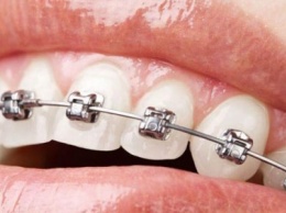 В Херсоне подростка 5 часов "морили" в стоматологии