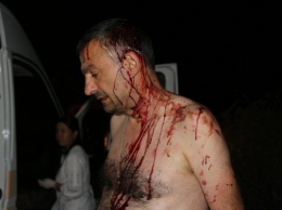 В Одесской области битами избили журналиста