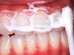 Протрите ваш рот на 60 секунд этой смесью и удалите зубной камень и зубной налет с ваших зубов!