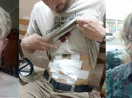 Переполох в банке с пауками: В Одессе избили очередную «свидомую» активистку