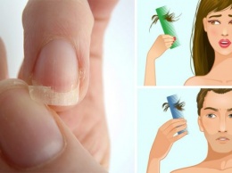 Если у вас тонкие ломкие ногти, выпадают волосы или вас мучает бессонница, начните потреблять это!