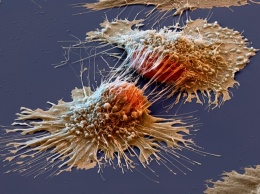 Эколог назвала бытовые вещи, которые могут спровоцировать рак