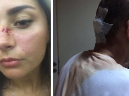 Русских туристов избили работники турецкого отеля. Среди жертв были и трезвые